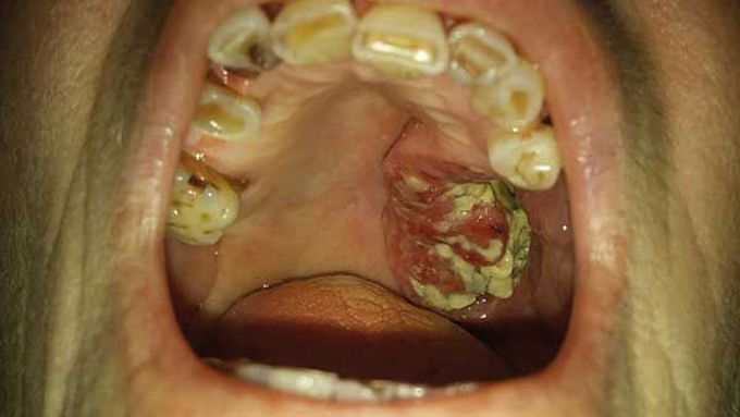 diagnosis..?