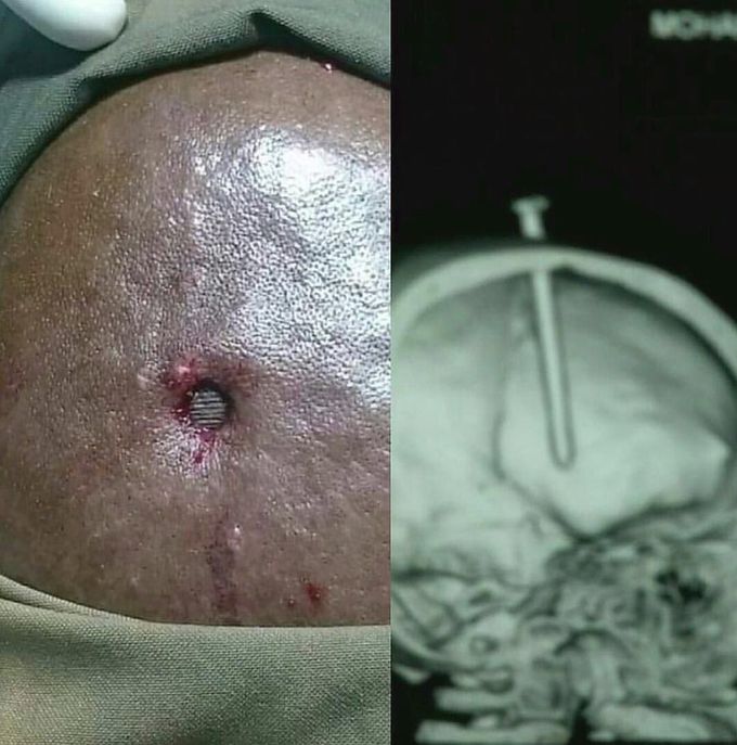 Amazing medical case
