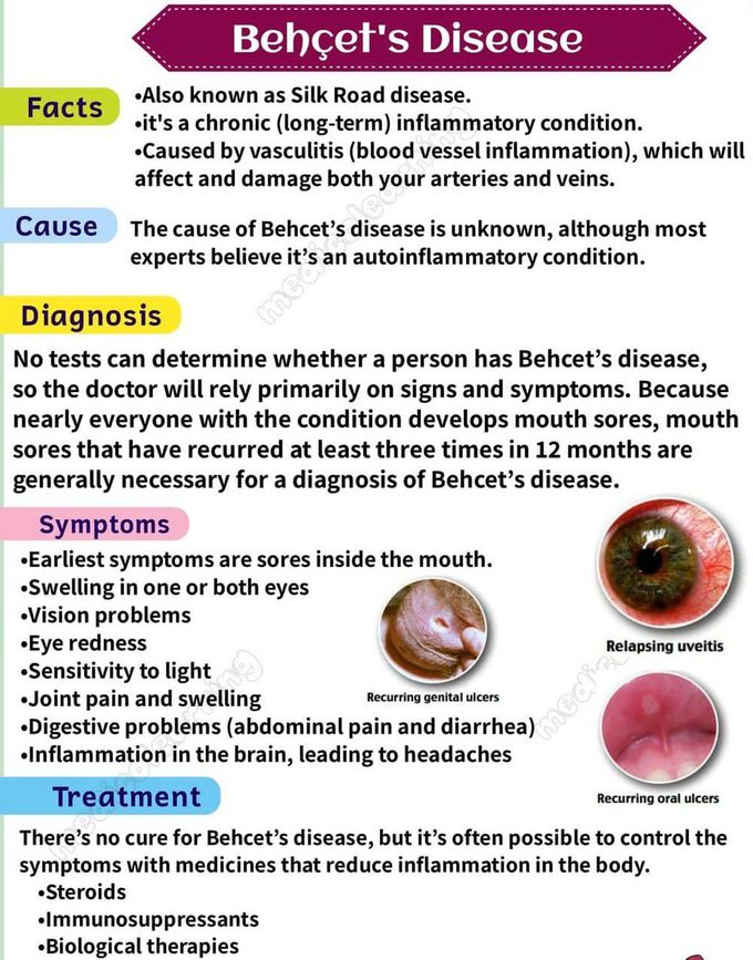 Behcet's Disease