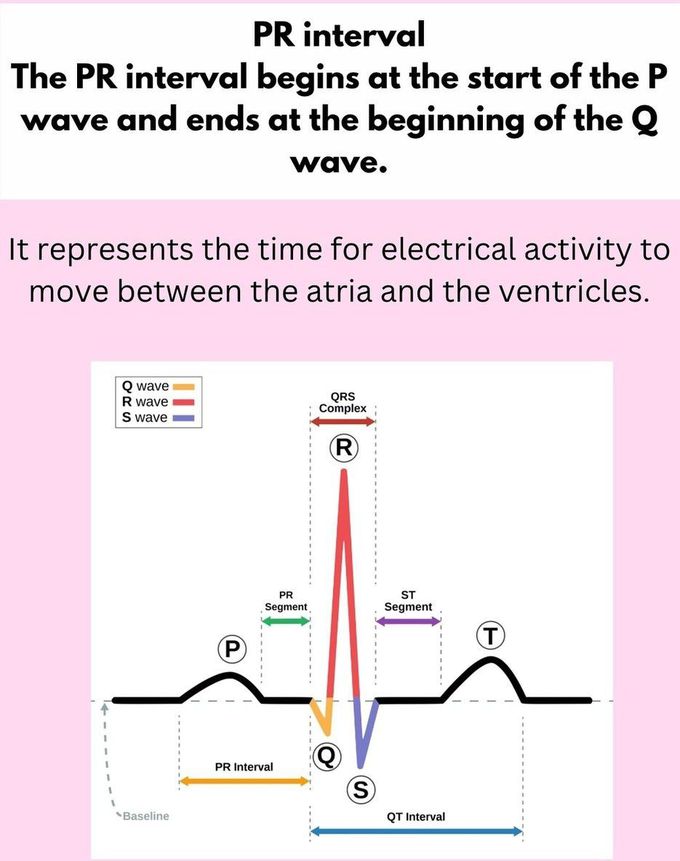 PR Interval