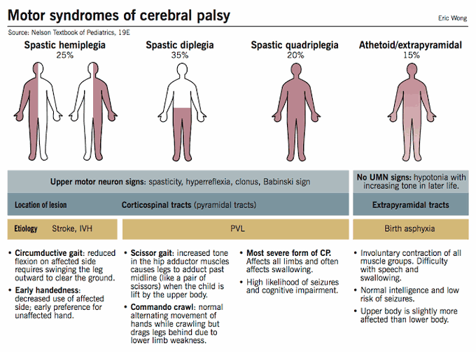 Motor Syndrome of Cerebral Palsy