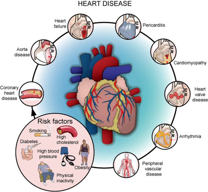 Heart disease - MEDizzy