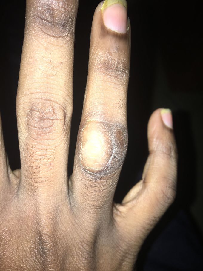 What’s this disease?