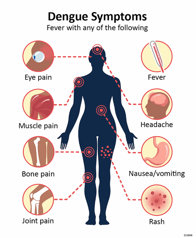 Dengue