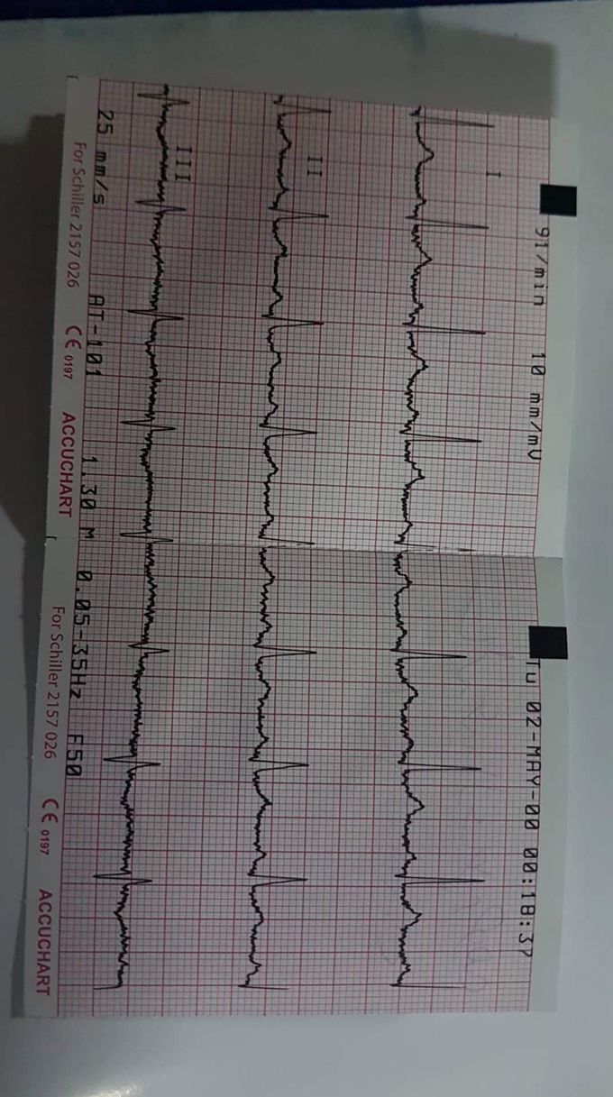 How to confirm this ECG ?
