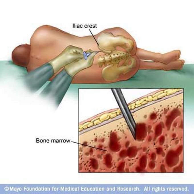 Pin on Poor Old Broken Down Body