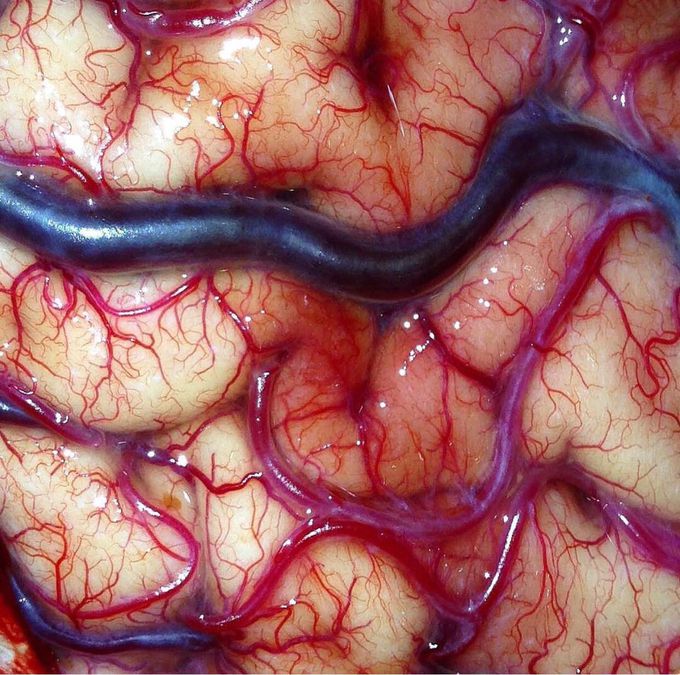 Close-up shot of cerebral cortex