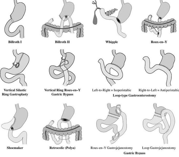 General surgery MEDizzy