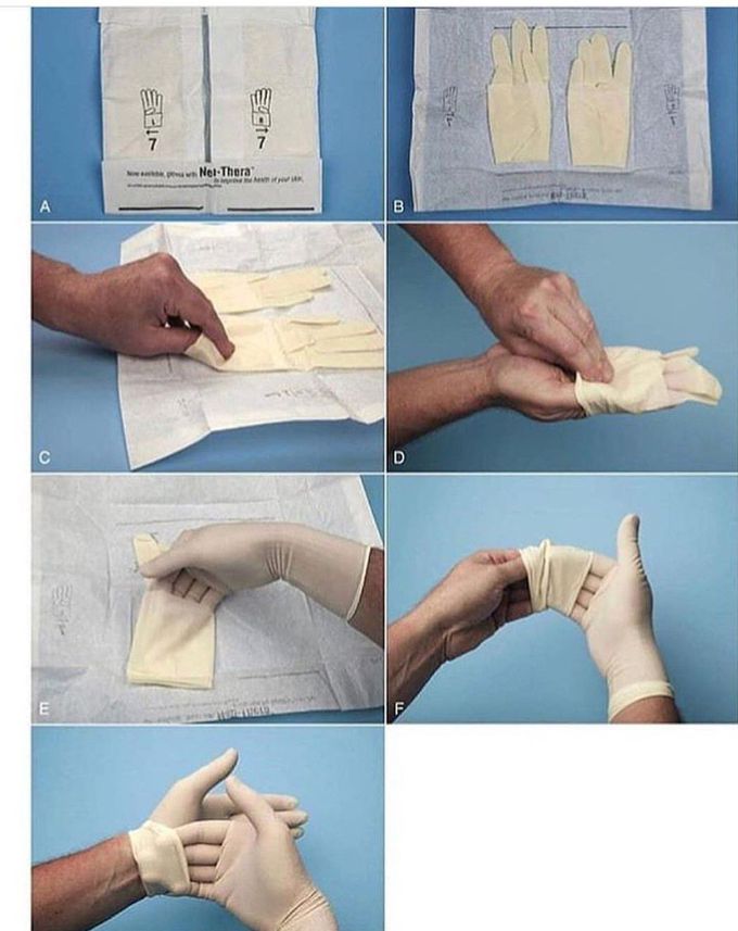 Gloves