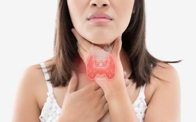 Treatment for Thyrotoxicosis