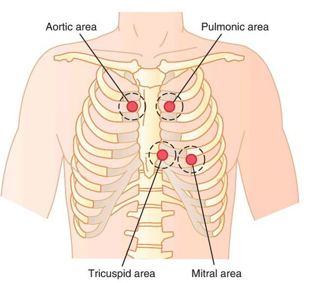 Best areas for auscultation