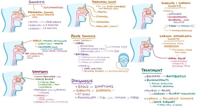 Sinusitis