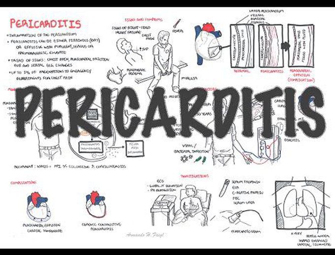 The pathology of pericarditis