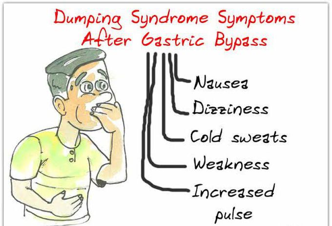 These are the symptoms of Dumping syndrome