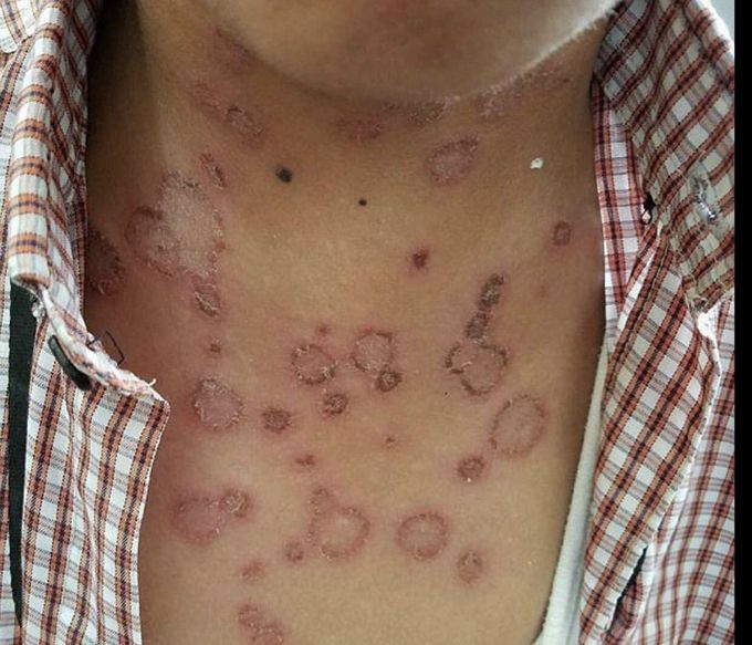 Whts the diagnosis ? 🤔🤔