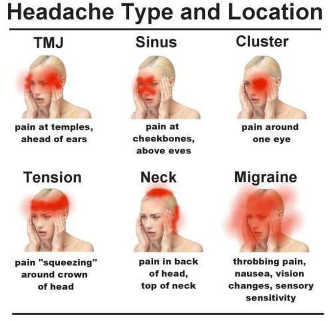 Types of headaches