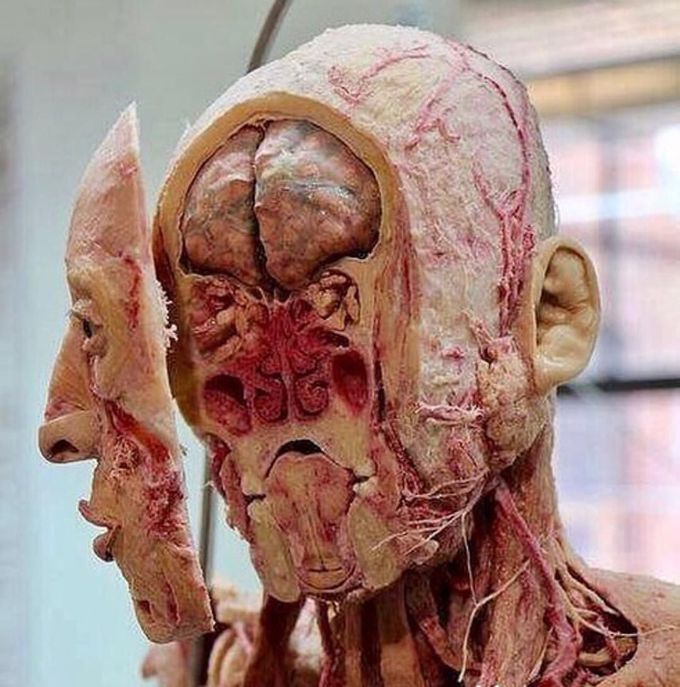 Incredible view of the human head Highlighting Sinuses there in. 