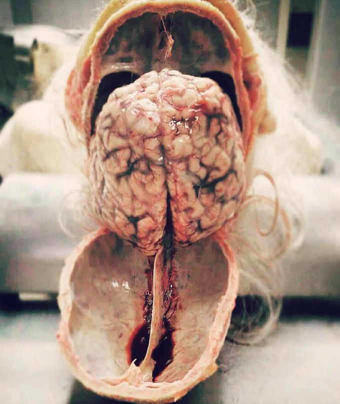 Human central nervous system beautifully dissected