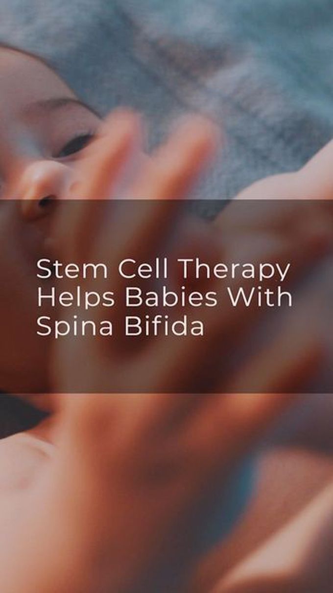Stem Cell Treatment for Spina Bifida