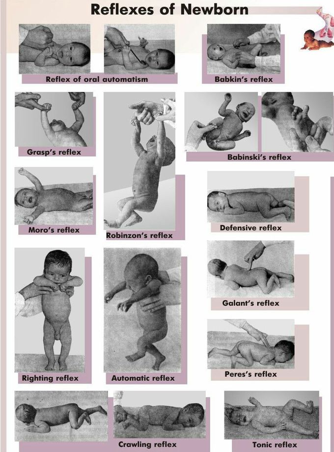 neonatal reflexes