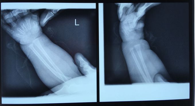 What's diagnosis?