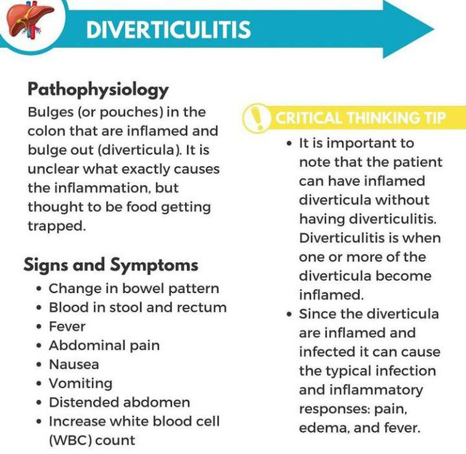 Diverticulitis