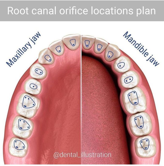 Root Canal Orifice Location