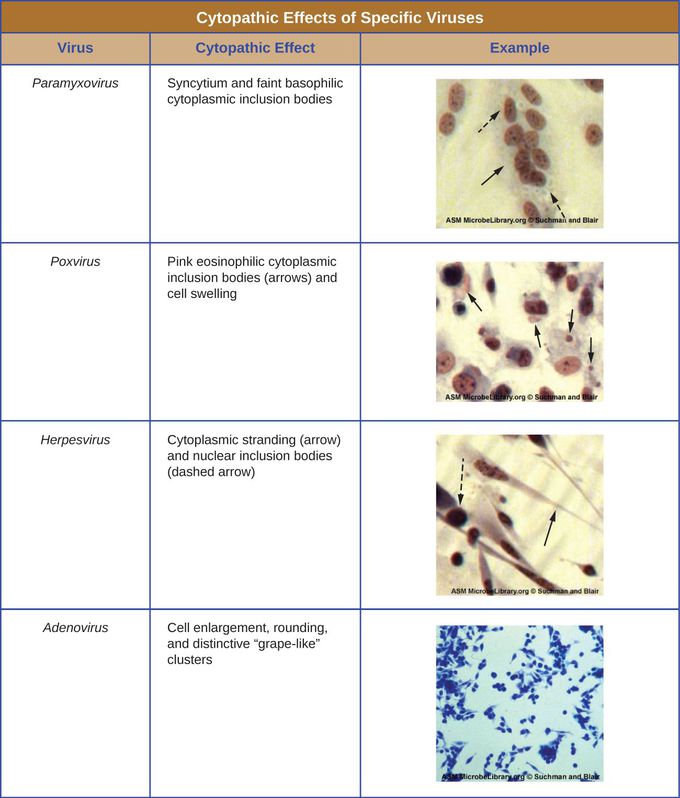 Cytopathic effect