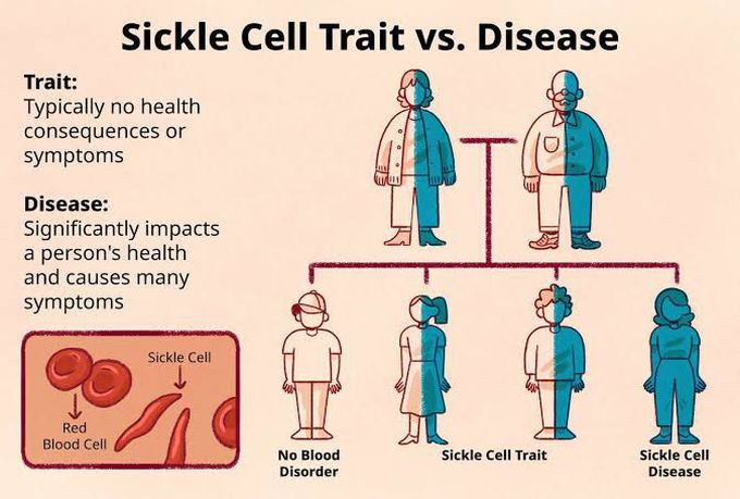 Sickle cell trait vs disease