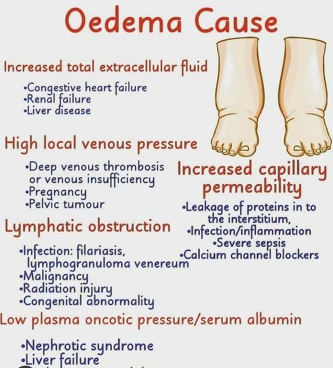 EDEMA