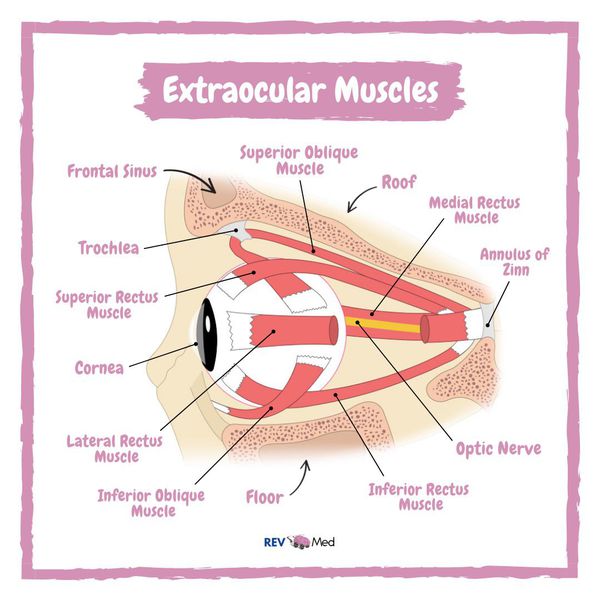 Medial rectus and inferior oblique dmg