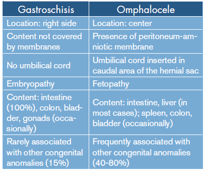 Gastroschisis vs Omphalocele