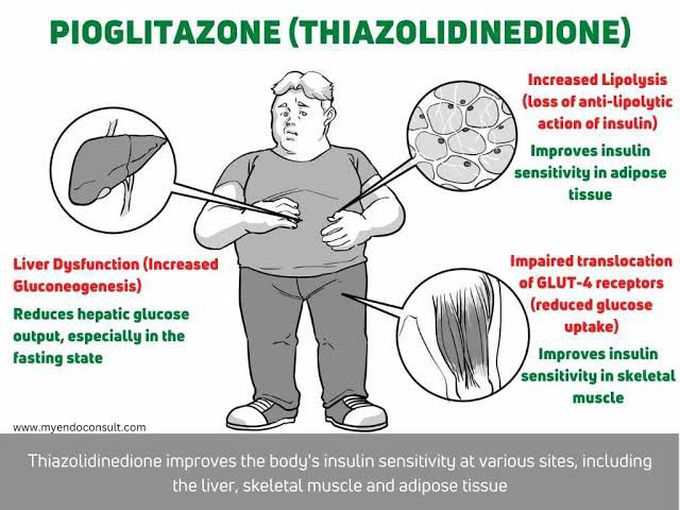 Pioglitazone (Thiazolidinedione)
