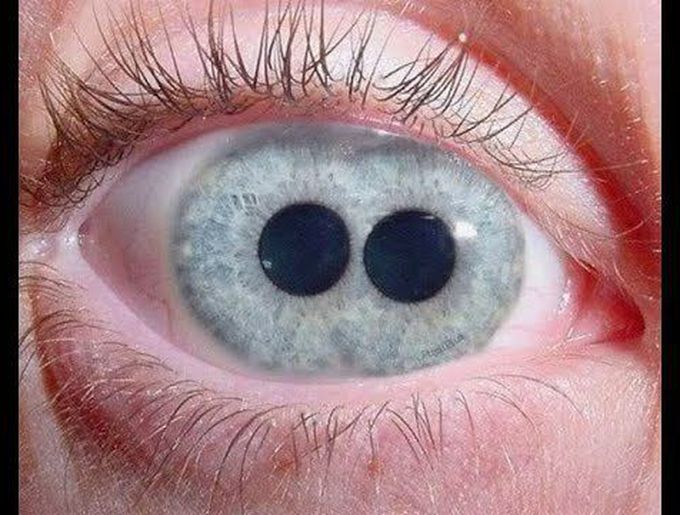 Who Knows about this disease 🤔