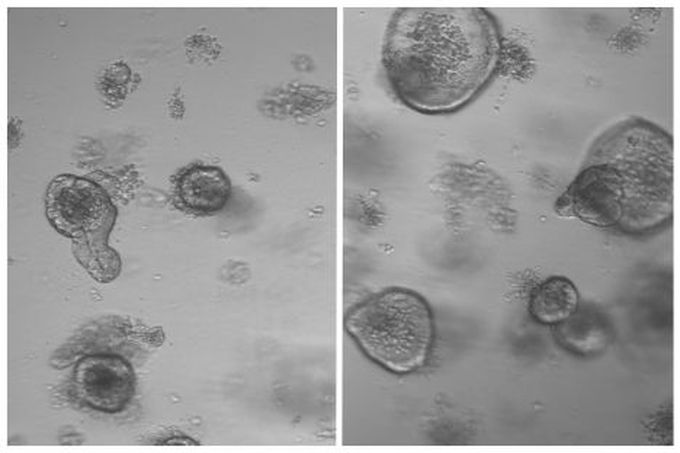 Fasting boosts stem cells’ regenerative capacity