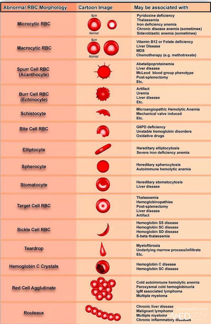 Poikilocytosis refers to an increase in abnormal red blood cells of any shape that makes up to 10% or more of the total population. Poikilocytes can be flat, elongated, teardrop-shaped, crescent-shaped, sickle-shaped, or can have pointy or thorn-like projections, or may have other abnormal feature.