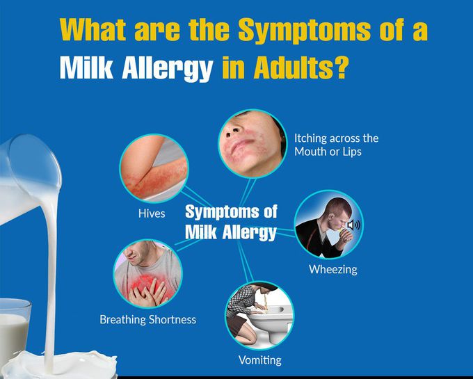 Milk allergy