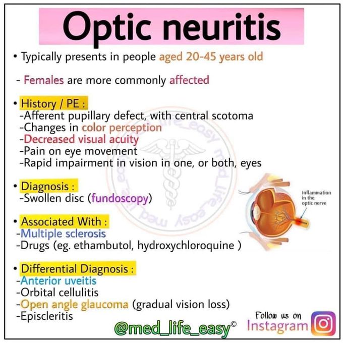 Optic neuritis