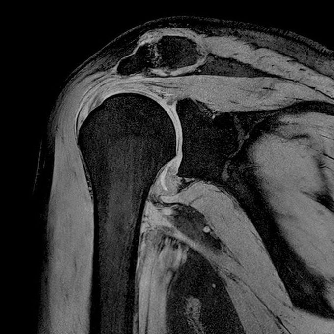Terra7 MSK morphology imaging