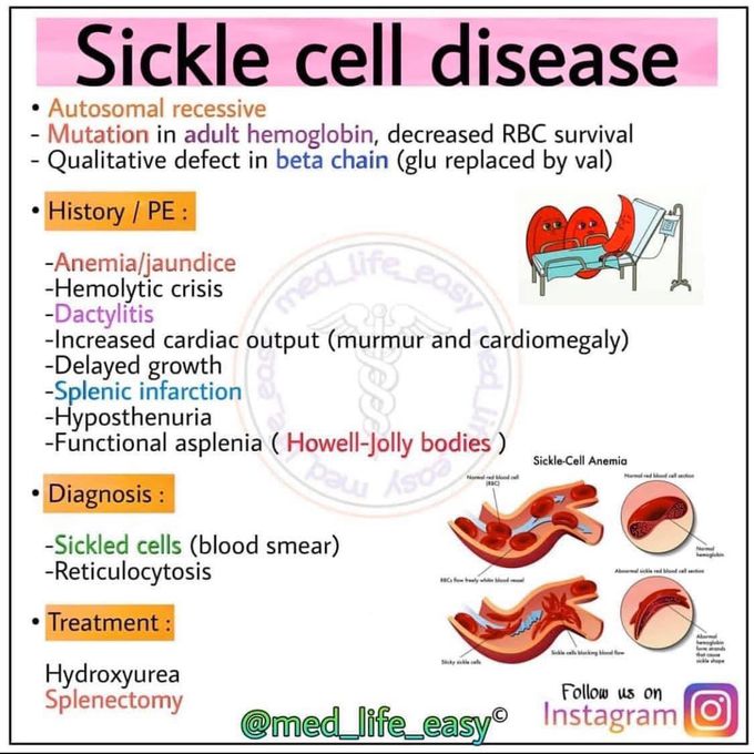 Sickle cell disease