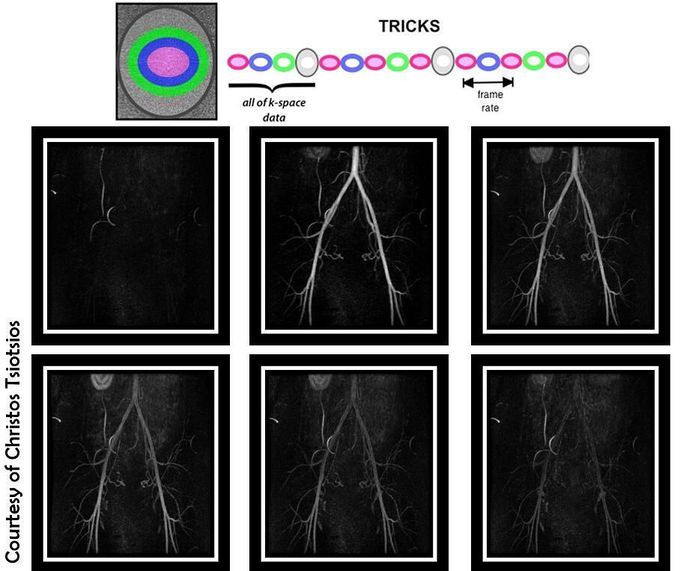 Time Resolved Imaging of Contrast KineticS