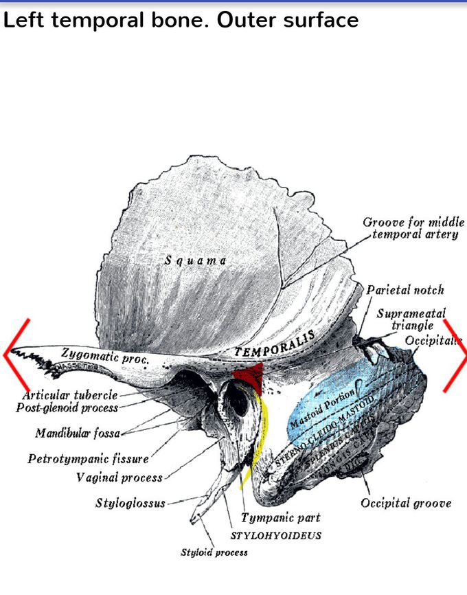 Temporal bone