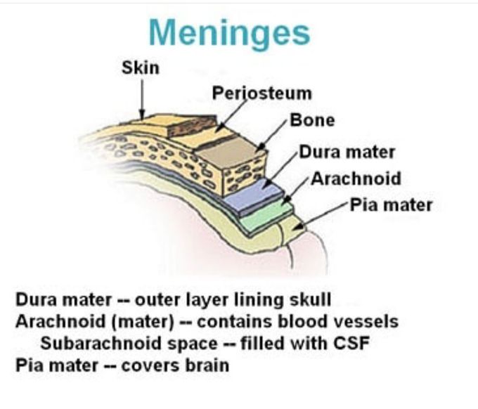 Meningitis