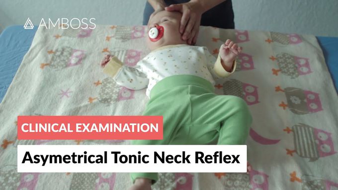 Asymmetrical Tonic Neck Reflex - Clinical Examination