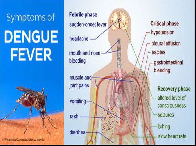 Dengue Fever