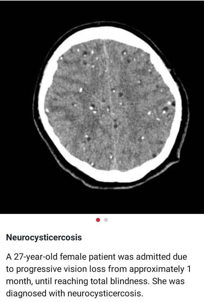 Neurosurgery