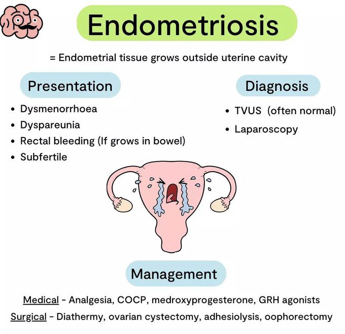 Endometriosis