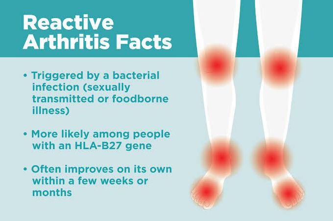 Reactive Arthritis