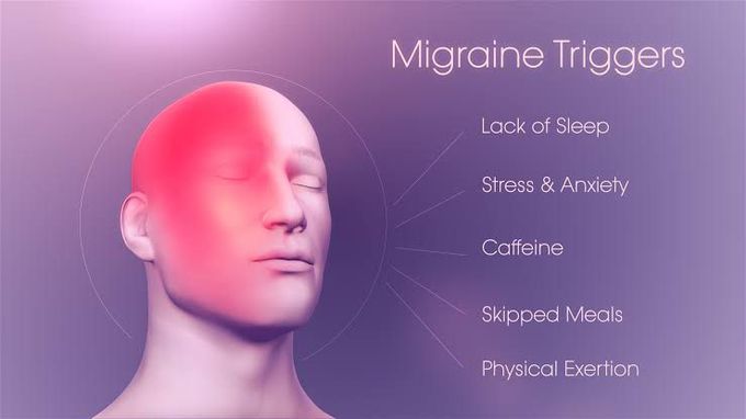 Migraine