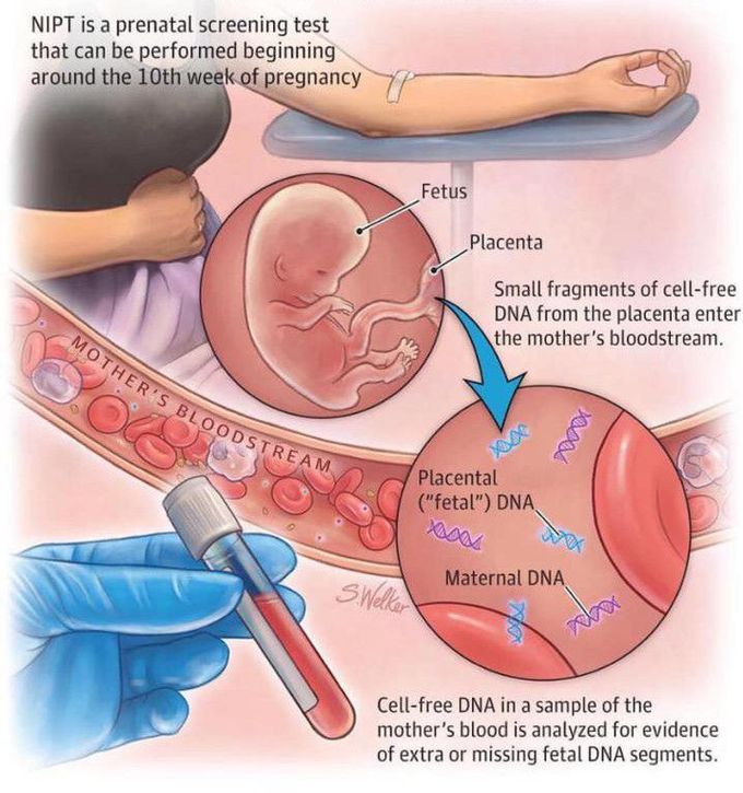 Non-invasive prenatal screening test